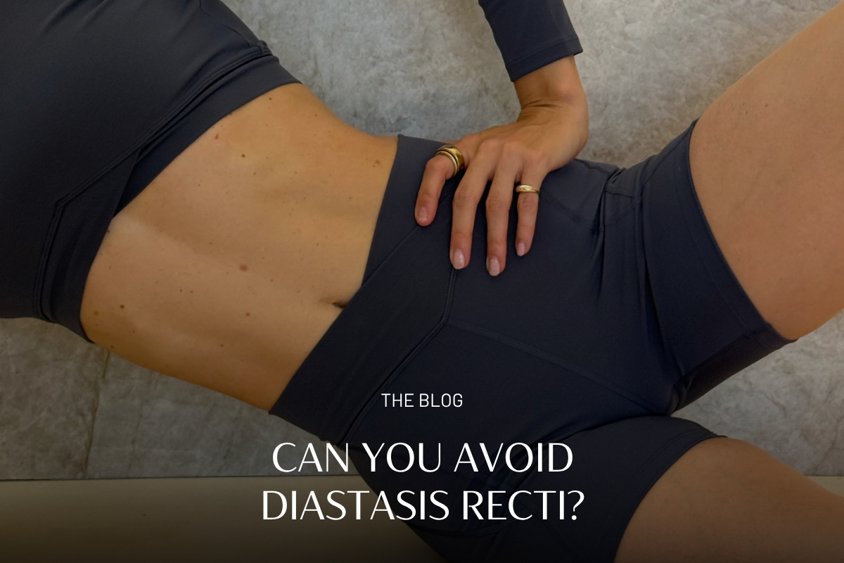 Think You Have Diastasis Recti? Here’s What To Know